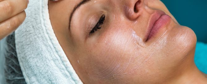 Brushing on chemical peel