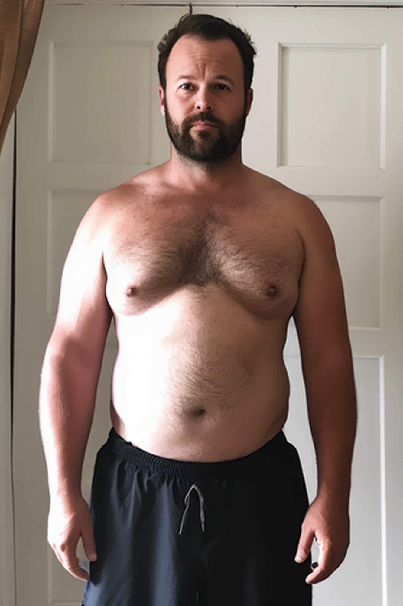 James Before Weight Loss treatment